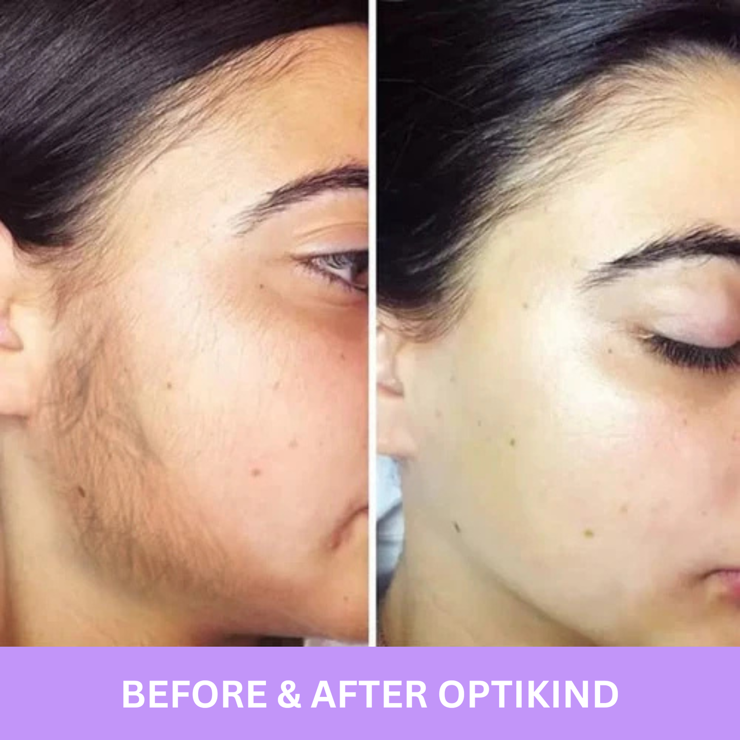 Cyperus Rotundus Oil