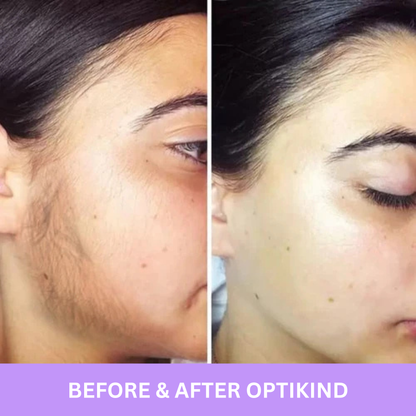 Cyperus Rotundus Oil