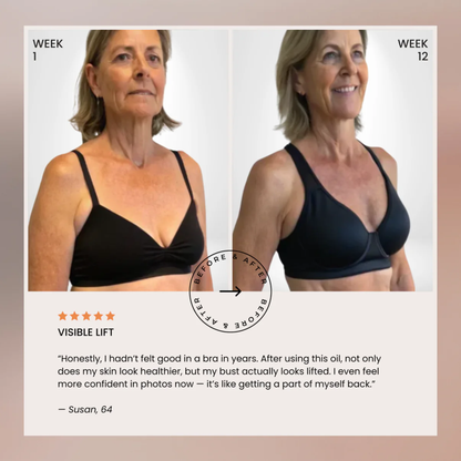 Bust Lift Oil - Naturally Lifted, Fuller Bust