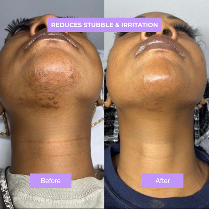 Cyperus Rotundus Oil