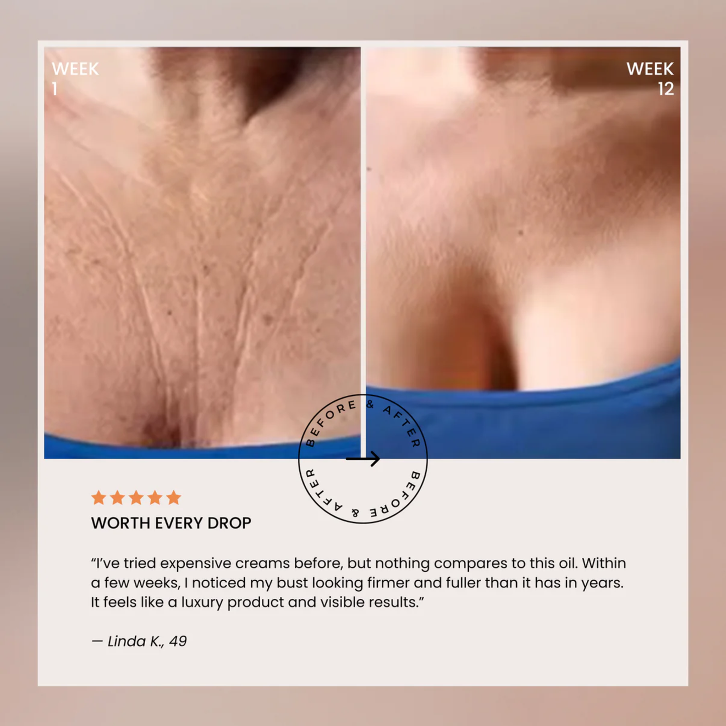 Bust Lift Oil - Naturally Lifted, Fuller Bust