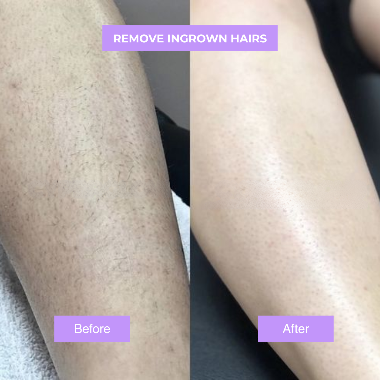 Cyperus Rotundus Oil