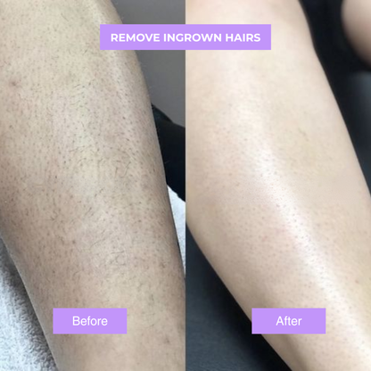 Cyperus Rotundus Oil