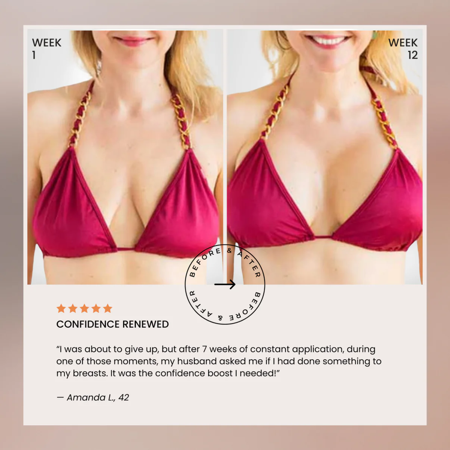 Bust Lift Oil - Naturally Lifted, Fuller Bust