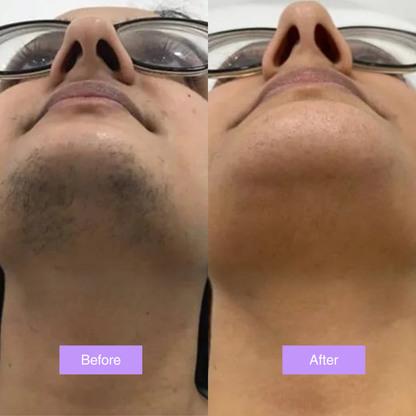 Cyperus Rotundus Oil