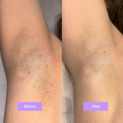 Cyperus Rotundus Oil